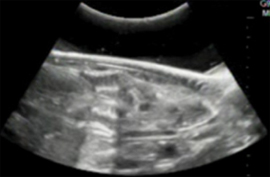 図-6　ツノザメ胎仔のエコー診断画像