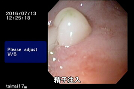 図-3　雌タイマイの卵管内への精液注入（内視鏡を使用）