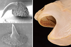 図-3　歯が生えている妊娠初期のホホジロザメの胎仔. （右）頭部の拡大写真　（左）歯の電子顕微鏡写真
