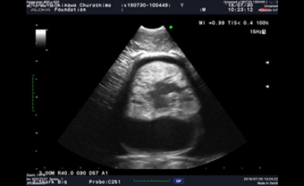 写真-2ジンベエザメ心臓のエコー画像