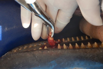 写真-5　ミナミバンドウイルカ抜歯処置