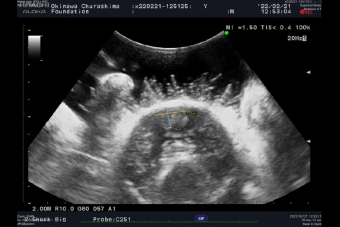 写真-1シラヒゲウニの超音波診断画像